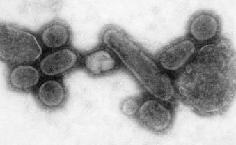 Reconstructed_Spanish_Flu_Virus